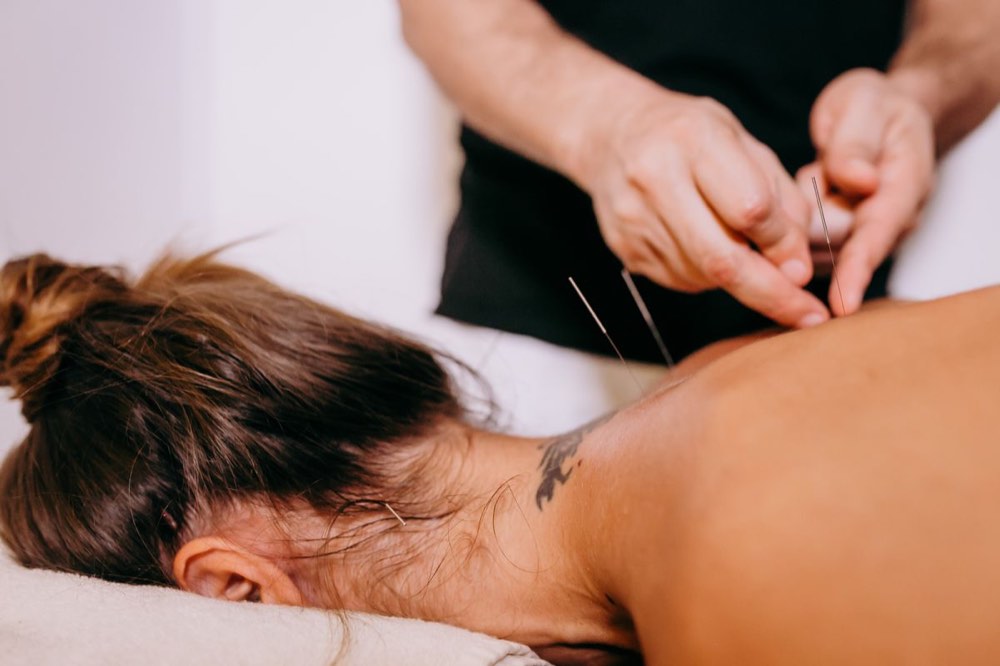 Wat kunt u verwachten van uw eerste acupunctuurbehandeling?