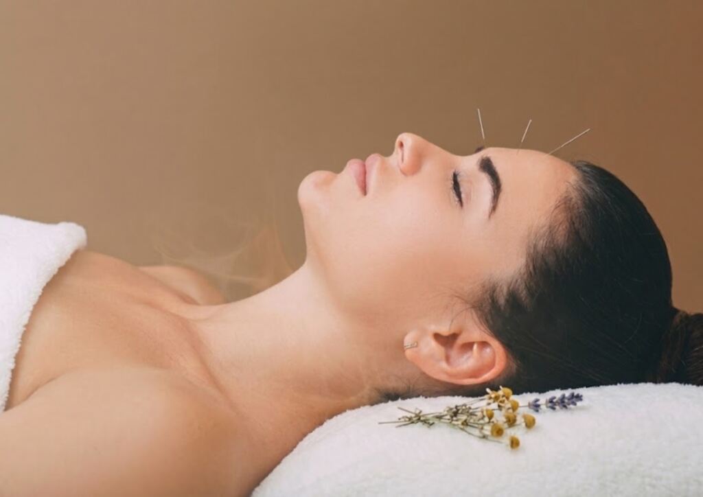 Cosmetische acupunctuur