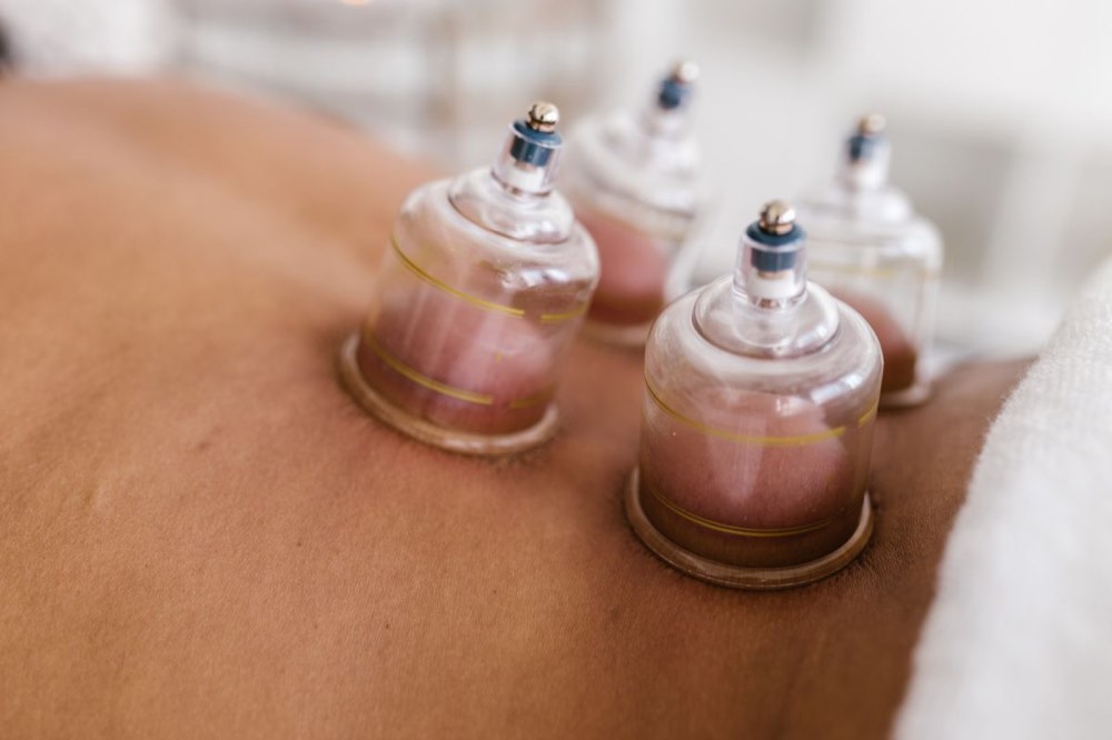 Cupping, guasha & moxa