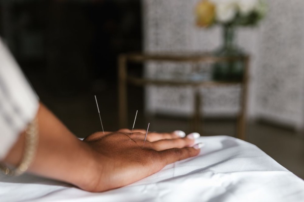 Triggerpoint & dry needling